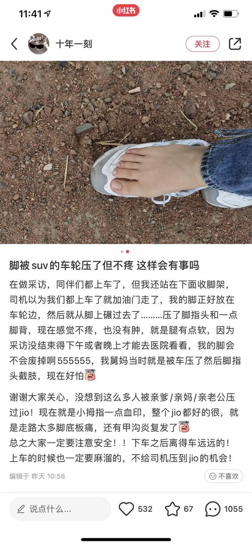 被车压了脚怎么处理 被车压了脚怎么处理赔偿标准