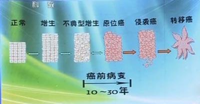 男性修车对怀孕的影响：神秘的车间里隐藏的健康隐患